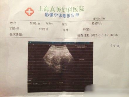 袁莉被曝怀孕1个月外籍老公兴奋晒婴儿b超照图