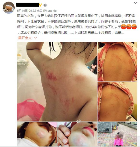 网曝3岁女孩在幼儿园被老师打伤 警方正调查(图)