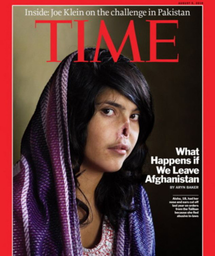 阿富汗遭割鼻女子重获美丽容貌